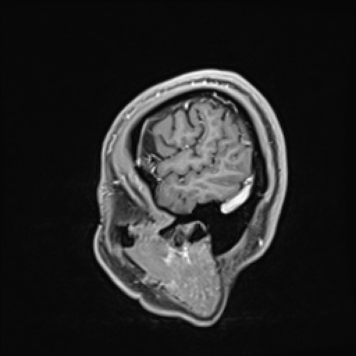 Click on the Serie image to view the images of VILLANUEVA, WILLIAM A.